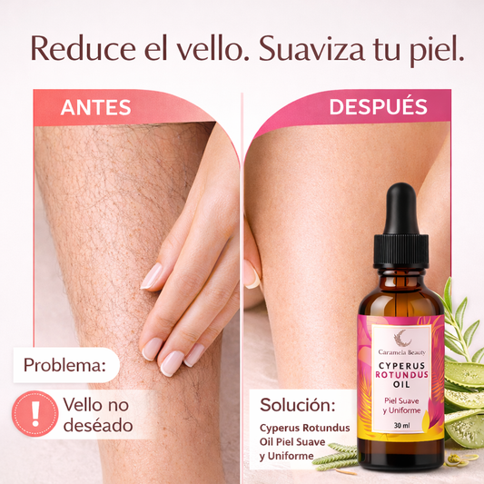 Cyperus Rotundus Oil – Piel Suave y Uniforme